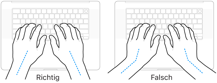 Tastatur und Hände in richtiger und falscher Haltung von Handgelenk und Händen