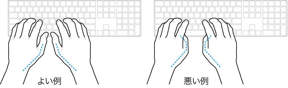 キーボードに置かれた手。親指の適切な位置と不適切な位置を示しています。