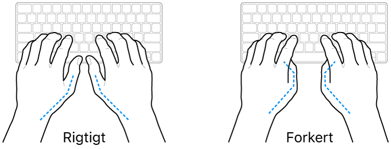 Hænder anbragt over et tastatur med rigtig og forkert position af tommelfingre.