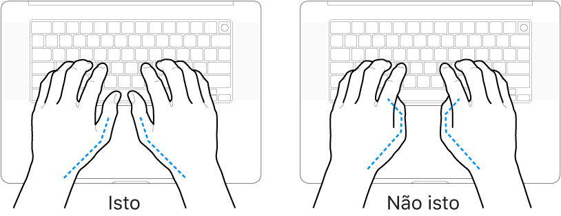 Mãos posicionadas sobre um teclado, mostrando os alinhamentos correto e incorreto dos polegares.