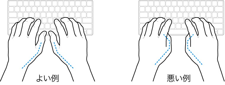 キーボードに置かれた手。親指の適切な位置と不適切な位置を示しています。