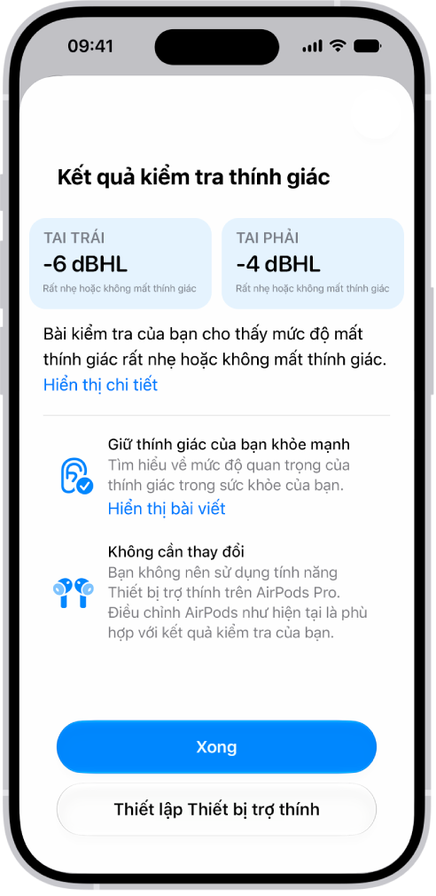 Kết quả Kiểm tra thính giác trên iPhone, đang hiển thị mức độ mất thính giác rất nhẹ hoặc không mất thính giác trong cả hai tai. Ở dưới cùng là các tùy chọn để chạm vào Xong hoặc thiết lập Thiết bị trợ thính.