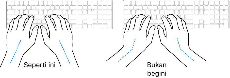 Tangan diposisikan di atas keyboard, menampilkan penyejajaran pergelangan tangan dan tangan yang benar dan salah.