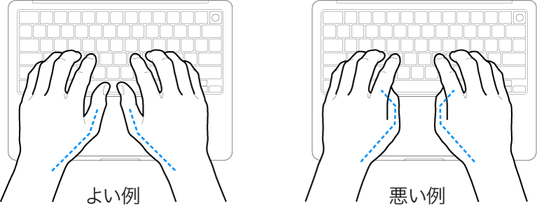 キーボードに置かれた手。親指の適切な位置と不適切な位置を示しています。