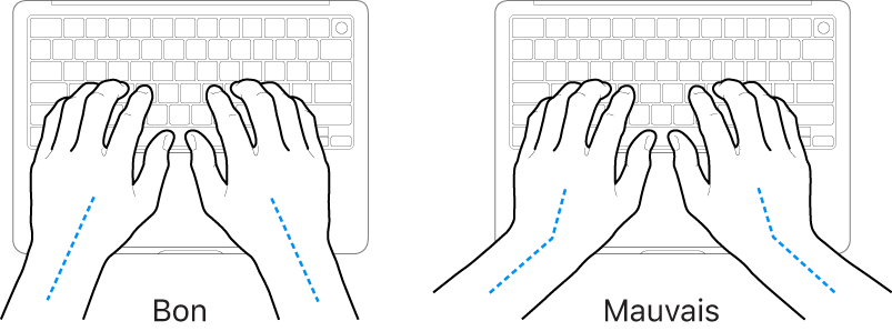 Mains placées sur un clavier, montrant le bon et le mauvais alignement des poignets et des mains.