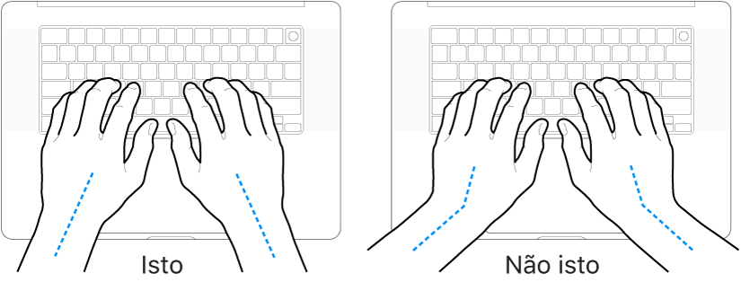 Mãos posicionadas sobre um teclado, mostrando os alinhamentos correto e incorreto do pulso e da mão.