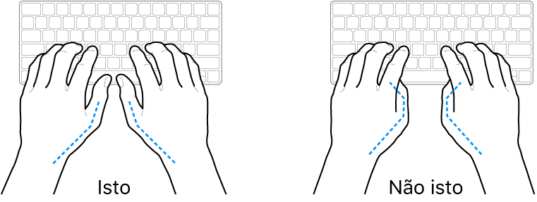 Mãos posicionadas sobre um teclado, mostrando os alinhamentos correto e incorreto dos polegares.