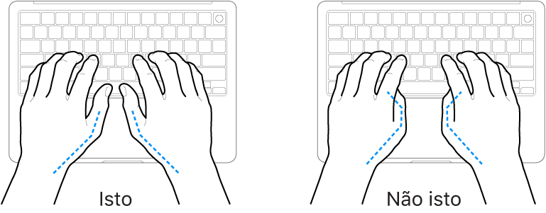 Mãos posicionadas sobre um teclado, mostrando os alinhamentos correto e incorreto dos polegares.