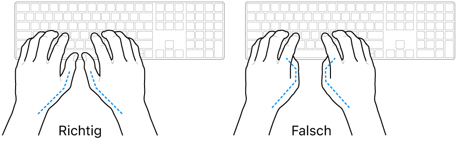 Hände über einer Tastatur, die die korrekte und falsche Platzierung der Daumen zeigen.